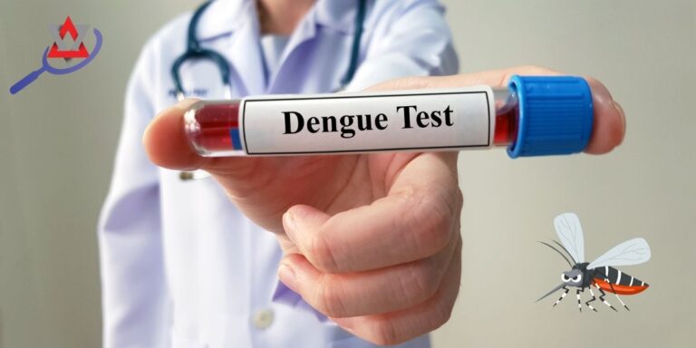 dengue-fever-symptoms-treatment-bangla
