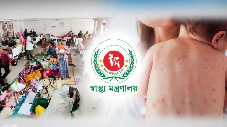 ২৪ ঘণ্টায় হামের উপসর্গ নিয়ে ৩ শিশুর মৃত্যু, আক্রান্ত ১,১০৬